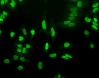 Acetylated Lysine, FITC conjugated in the group Antibodies Plant/Algal / DNA/RNA/Cell Cycle / Epigenetics/DNA methylation at Agrisera AB (Antibodies for research) (AS15 3020)